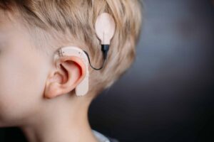 Implante coclear, un dispositivo contra el silencio