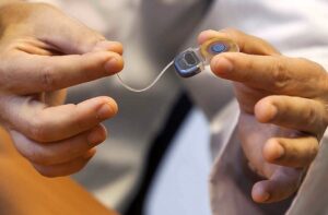 El renacer del sonido: implantes cocleares 