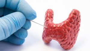 La glándula silenciosa que puede estar afectando tu salud sin que lo sepas